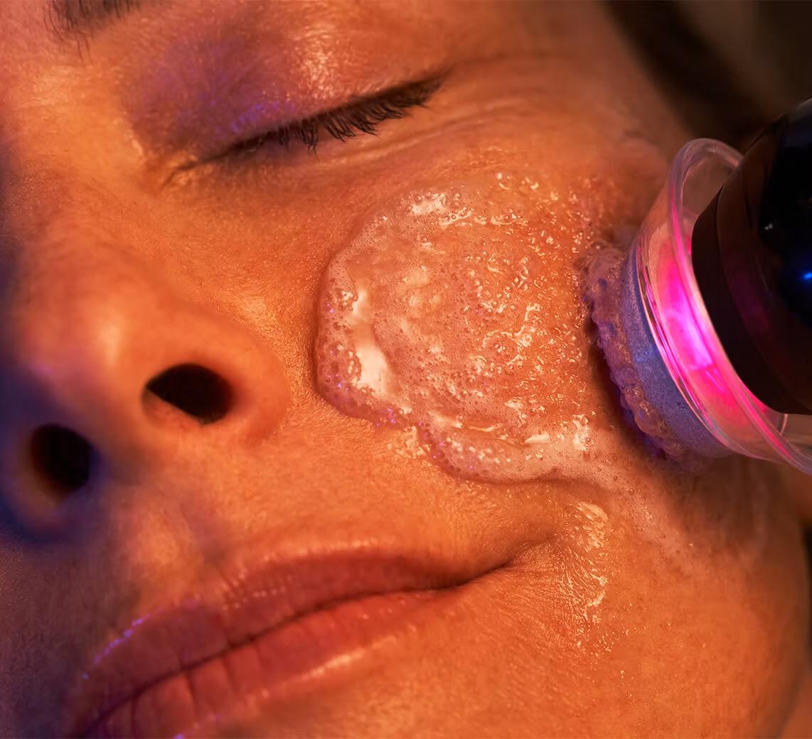 woman's face getting glo2 facial